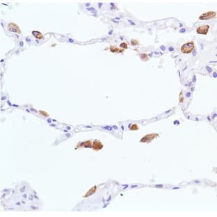 Rabbit Monoclonal Antibodies