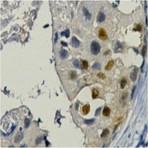Anti-PCNA Mouse Monoclonal Antibody (1D7)