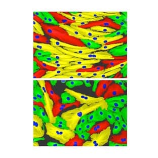 Custom RNAi Services & RNAi Screens