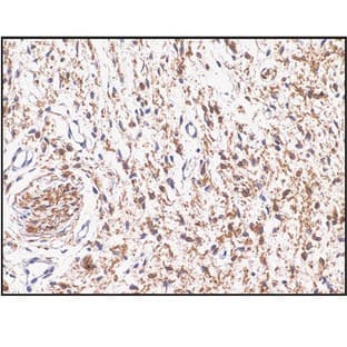 S-100 (DB 055) avatar