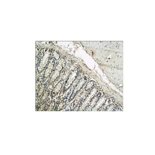 IL-1 beta Antibody avatar