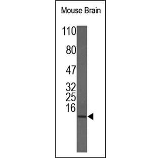 IGF1 Antibody avatar
