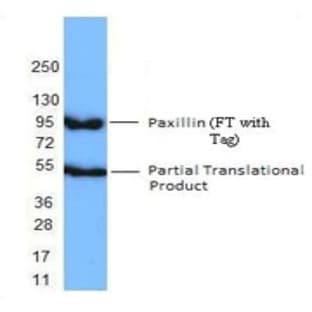 Recombinant Human Paxillin