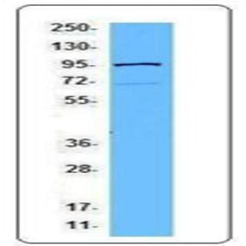 Purified anti-STAT 5b avatar