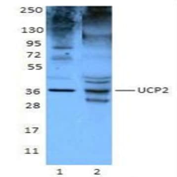 Purified anti-UCP2