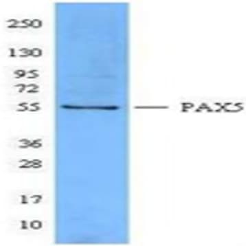 Purified anti-Pax-5 avatar