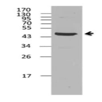 Purified anti-PME-1 avatar