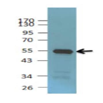 Purified anti-Rad23B avatar