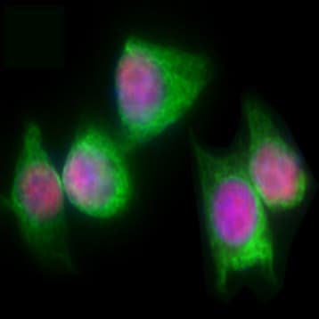 Purified anti-p63 (deltaN) avatar