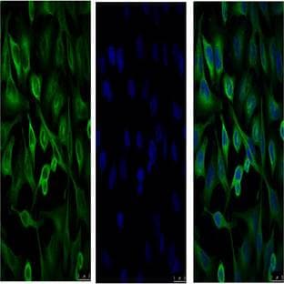 Anti-?-Tubulin Monoclonal Antibody (3G5)