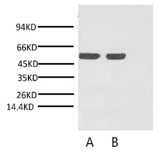 Anti-Rubisco (Large Chain) Monoclonal Antibody (9Y6) avatar