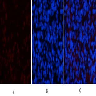 ERK1 Mouse Monoclonal Antibody(5E9) avatar