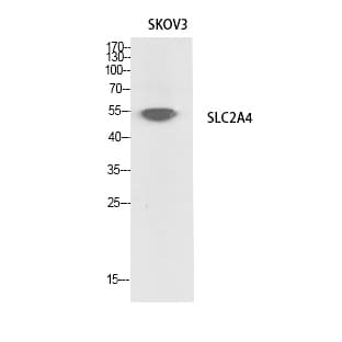 Glut4 Polyclonal Antibody avatar