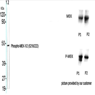 MEK-1/2 (phospho Ser218/222) Polyclonal Antibody avatar