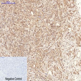 phospho-MLKL (S358) Mouse Monoclonal Antibody(6F8) avatar
