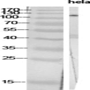PI 3-kinase p110? Polyclonal Antibody avatar