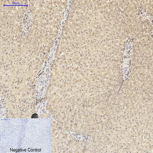 ASC Polyclonal Antibody avatar