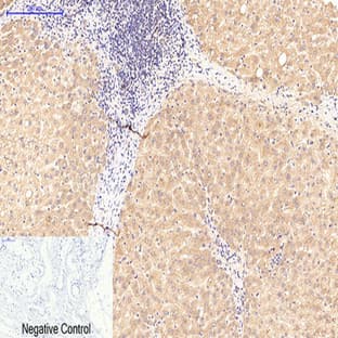 ATG5 Mouse Monoclonal Antibody(3C7) avatar