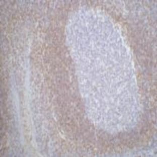 Bcl-2 Monoclonal Antibody avatar