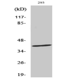 FAS Polyclonal Antibody avatar