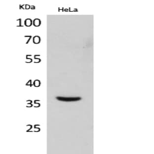 Mcl-1 Polyclonal Antibody avatar