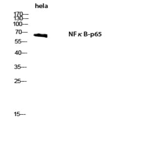 NF?B-p65 Polyclonal Antibody