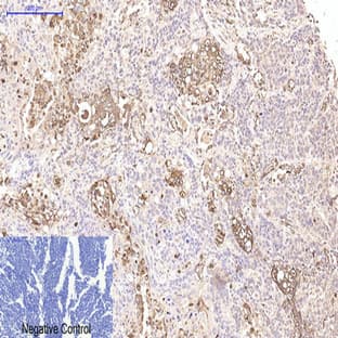CD15 Monoclonal Antibody avatar