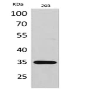 RANKL Polyclonal Antibody avatar