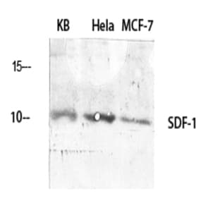 SDF-1 Polyclonal Antibody
