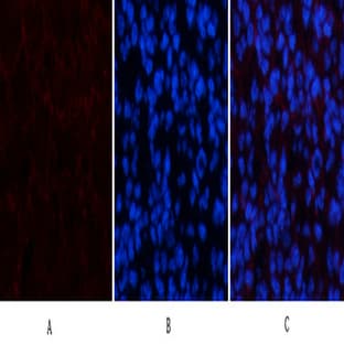Amyloid-? Polyclonal Antibody