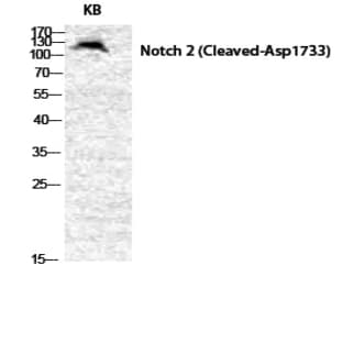 Cleaved-Notch 2 (D1733) Polyclonal Antibody avatar
