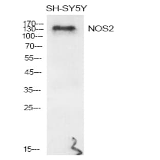 NOS2 Polyclonal Antibody avatar