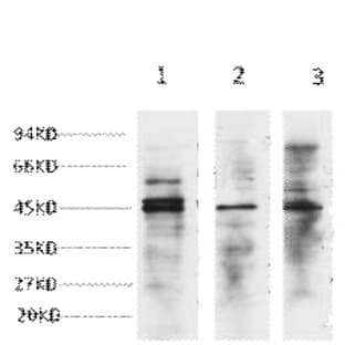 NSE Monoclonal Antibody avatar