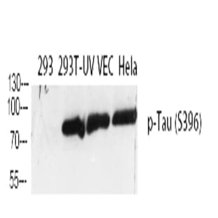 Tau (phospho Ser396) Polyclonal Antibody avatar
