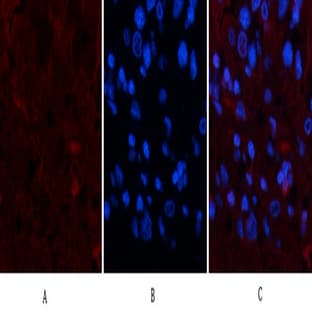 TTR Mouse Monoclonal Antibody(1D7) avatar