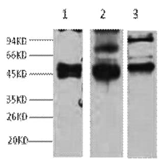 CK17 Monoclonal Antibody avatar