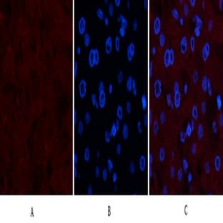 Collagen IV Mouse Monoclonal Antibody(8E5)