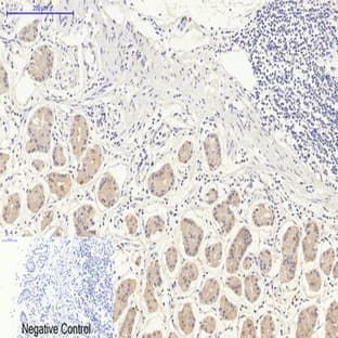 CHOP Mouse Monoclonal Antibody(2B1) avatar