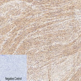 CREB-1 (phospho Ser133) Polyclonal Antibody