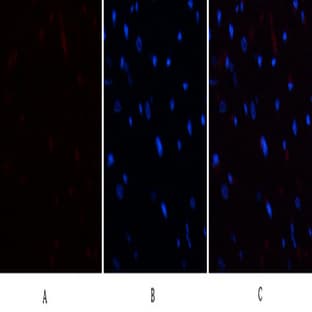 E2F-1 Polyclonal Antibody avatar
