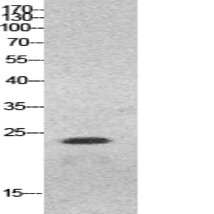 HMG-1 Polyclonal Antibody avatar