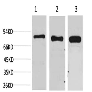p70 S6 kinase ? Polyclonal Antibody avatar