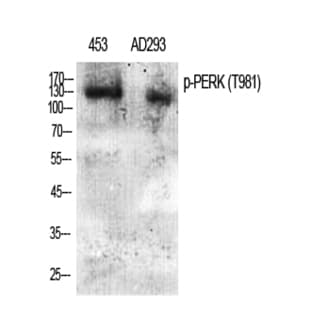 PERK (phospho Thr981) Polyclonal Antibody avatar