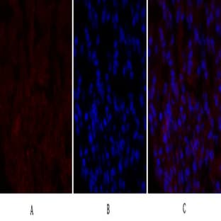 PERK Polyclonal Antibody avatar