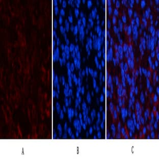 PPAR Delta Mouse Monoclonal Antibody(2F9) avatar