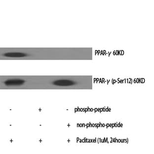 PPAR-? Polyclonal Antibody avatar