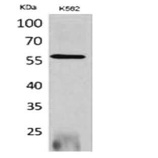 RUNX2 Polyclonal Antibody avatar