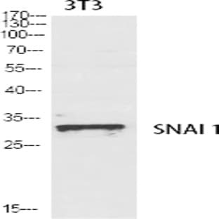 SNAI 1 Polyclonal Antibody avatar