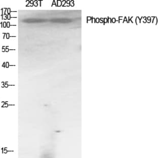FAK (phospho Tyr397) Polyclonal Antibody avatar