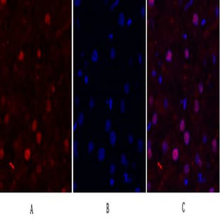 FAK Polyclonal Antibody avatar